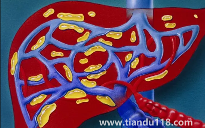 肝代謝不好吃什么調理4